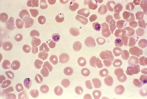 Babesia